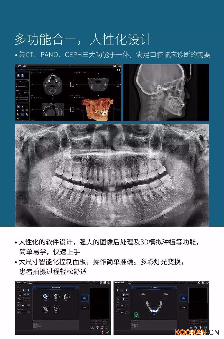 菲森CBCT多功能合一，人性化設計